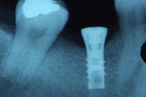 cassino dentista rongione associato