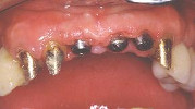 cassino dentista rongione frosinone