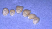 cassino dentista rongione via arigni