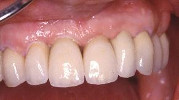 cassino dentista rongione 1
