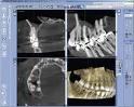 esami radiografici dentista cassino rongione