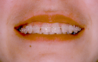 estetico dentista cassino